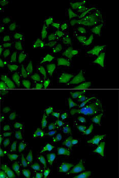 AIPL1 Rabbit Polyclonal Antibody (CAB14113)