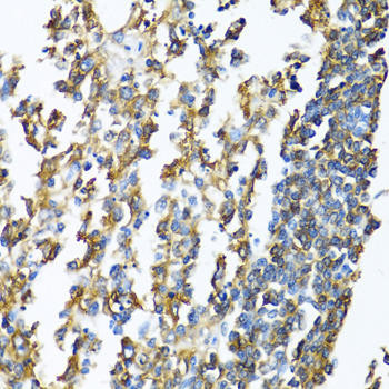 HLA-DPB1 Rabbit Polyclonal Antibody (CAB1412)