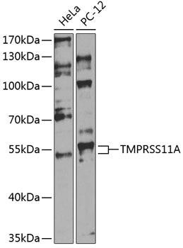 TMPRSS11A Rabbit Polyclonal Antibody (CAB14167)