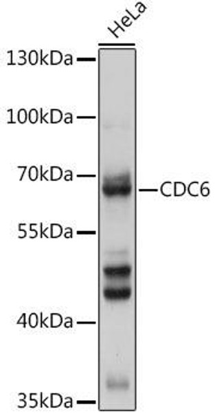 Anti-CDC6 Antibody (CAB18249)