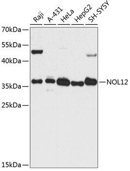 NOL12 Rabbit Polyclonal Antibody (CAB14292)