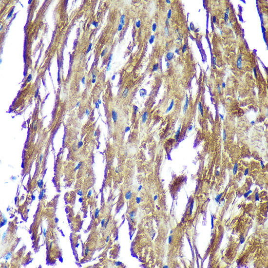 NDUFAF4 Rabbit Polyclonal Antibody (CAB14345)