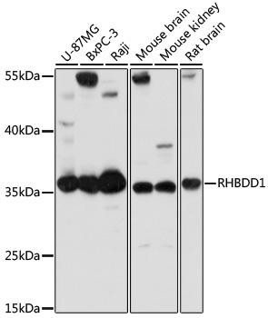 RHBDD1 Rabbit Polyclonal Antibody (CAB14350)