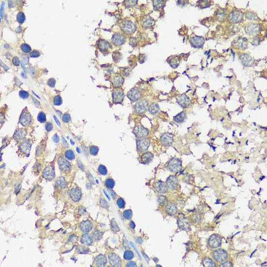 ASZ1 Rabbit Polyclonal Antibody (CAB14447)