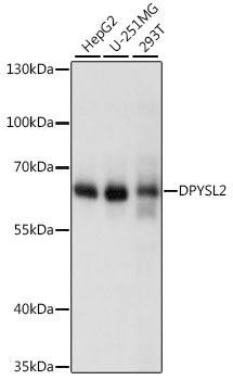 [KO Validated] CRMP2/DPYSL2 Rabbit Polyclonal Antibody (CAB14570)