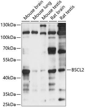 BSCL2 Rabbit Polyclonal Antibody (CAB14583)