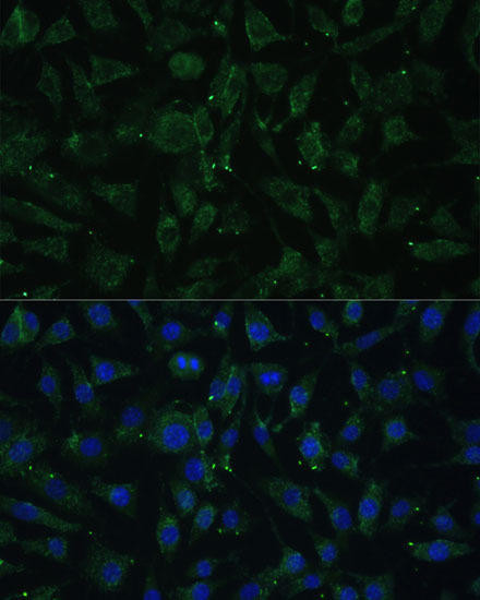 APH1A Rabbit Polyclonal Antibody (CAB14666)
