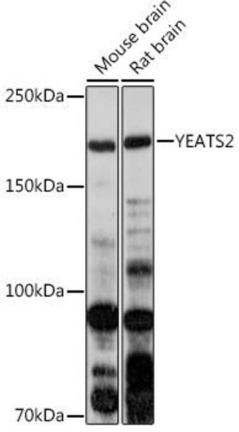 Anti-YEATS2 Antibody (CAB18666)