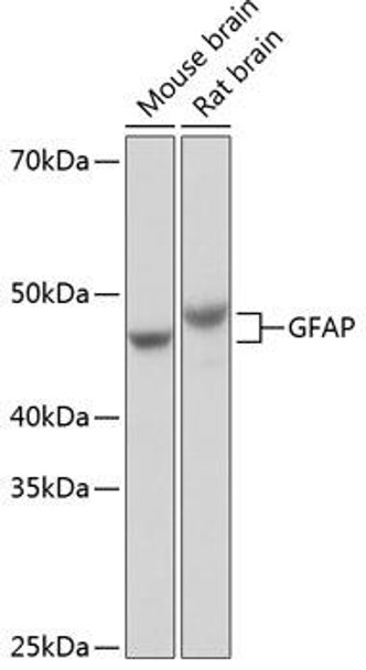 Anti-GFAP Antibody (CAB19058)