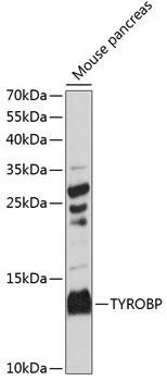 TYROBP Rabbit Polyclonal Antibody (CAB14794)