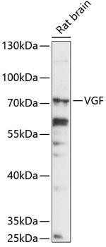 VGF Rabbit Polyclonal Antibody (CAB14795)