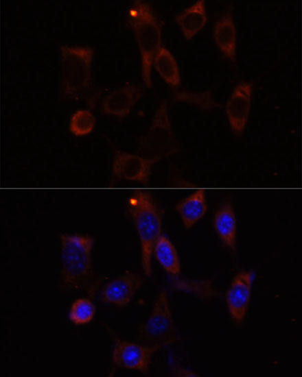 YTHDC2 Rabbit Polyclonal Antibody (CAB15004)
