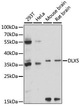 DLX5 Rabbit Polyclonal Antibody (CAB15049)
