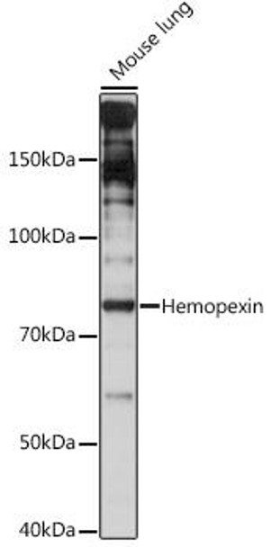 Anti-Hemopexin Antibody (CAB9133)
