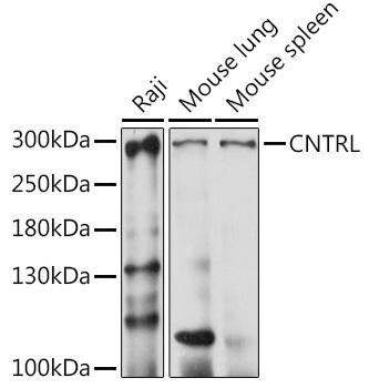 CNTRL Rabbit Polyclonal Antibody (CAB15138)
