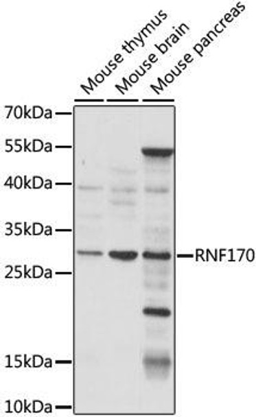 RNF170 Rabbit Polyclonal Antibody (CAB15195)
