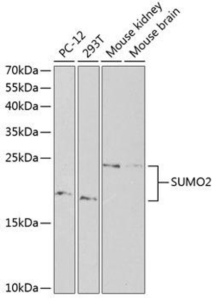 SUMO2/3 Rabbit Polyclonal Antibody (CAB1523)