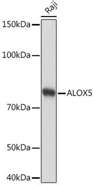 Anti-ALOX5 Antibody (CAB2877)