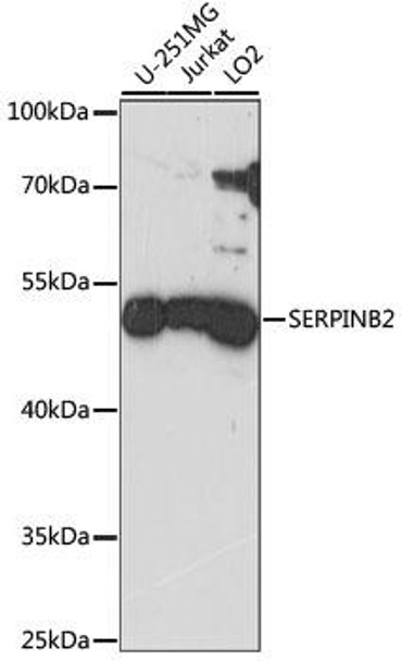 SERPINB2 Rabbit Polyclonal Antibody (CAB15297)
