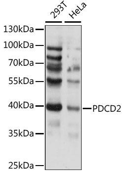 PDCD2 Rabbit Polyclonal Antibody (CAB15299)