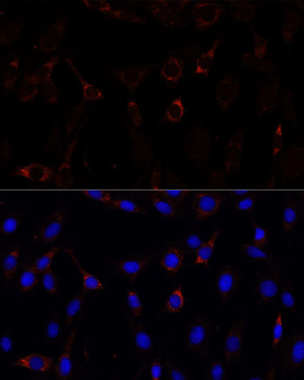 RNF112 Rabbit Polyclonal Antibody (CAB15333)