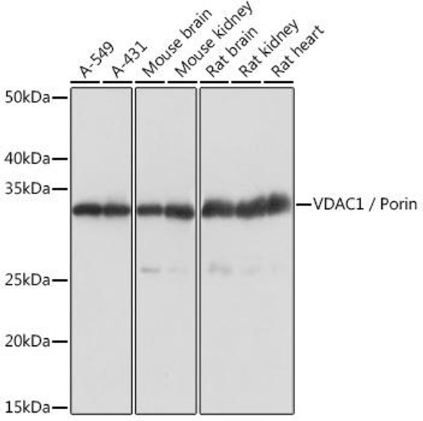 Anti-VDAC1 / Porin Antibody (CAB0810)