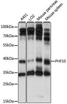 PHF10 Rabbit Polyclonal Antibody (CAB15466)