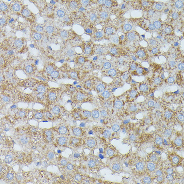 Haptoglobin (HP) Rabbit Polyclonal Antibody (CAB1571)
