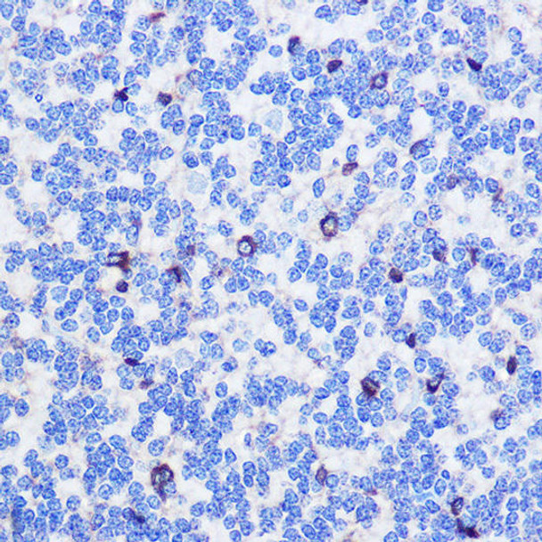 Anti-ASC / TMS1 Antibody (CAB11433)