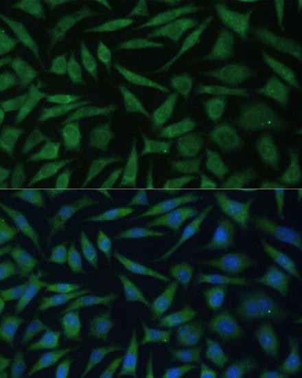 REXO2 Rabbit Polyclonal Antibody (CAB15808)