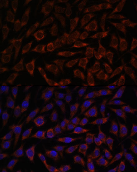 BZW2 Rabbit Polyclonal Antibody (CAB15823)