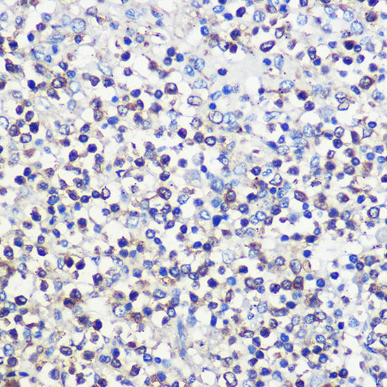 CD80 Rabbit Polyclonal Antibody (CAB16039)