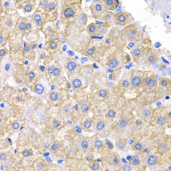 CRK/CRKII Rabbit Polyclonal Antibody (CAB1604)