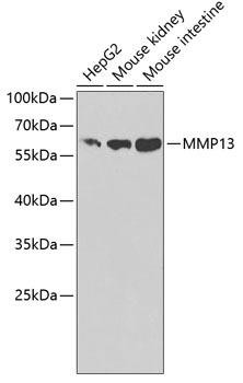 MMP13 Rabbit Polyclonal Antibody (CAB1606)