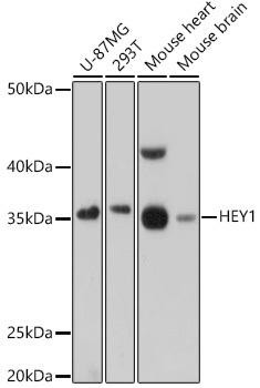 HEY1 Rabbit Polyclonal Antibody (CAB16110)