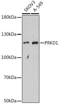 PKC mu Rabbit Polyclonal Antibody (CAB16185)