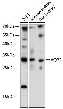 AQP2 Rabbit Polyclonal Antibody (CAB16209)