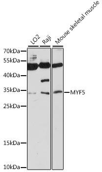 MYF5 Rabbit Polyclonal Antibody (CAB16227)