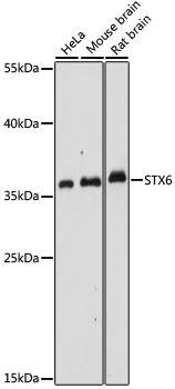STX6 Rabbit Polyclonal Antibody (CAB16283)