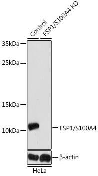 [KO Validated] FSP1/S100A4 Rabbit Polyclonal Antibody (CAB1631)