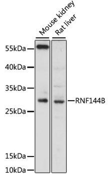 Anti-RNF144B Antibody (CAB13723)