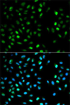 DTNBP1 Rabbit Polyclonal Antibody (CAB1632)