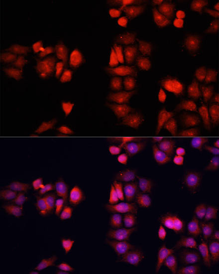 BMP1 Rabbit Polyclonal Antibody (CAB16353)