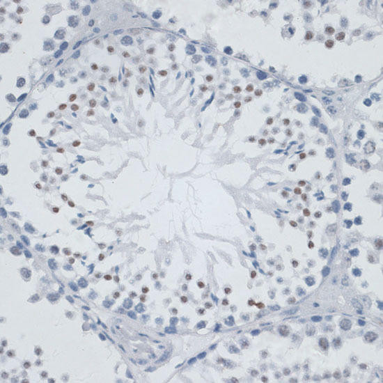 MSH6 Rabbit Polyclonal Antibody (CAB16381)