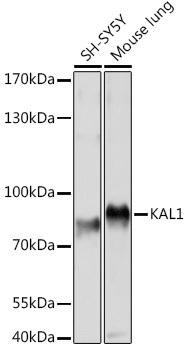 KAL1 Rabbit Polyclonal Antibody (CAB16389)