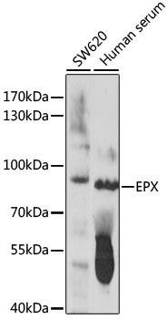 EPX Rabbit Polyclonal Antibody (CAB16450)