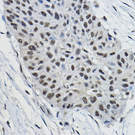 BRAP Rabbit Polyclonal Antibody (CAB16451)