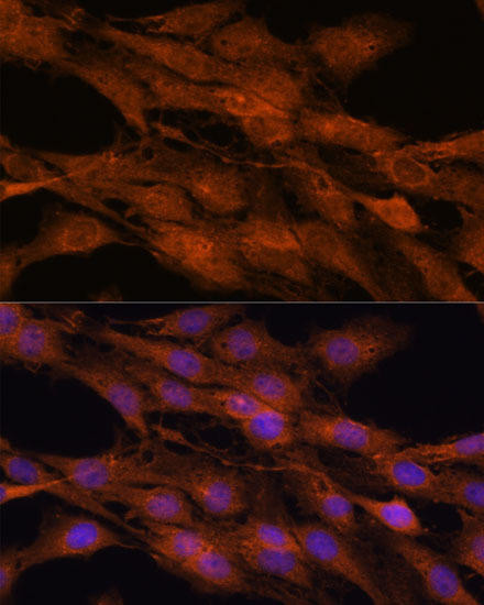 COMMD5 Rabbit Polyclonal Antibody (CAB16518)