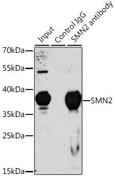 SMN2 Rabbit Polyclonal Antibody (CAB1652)