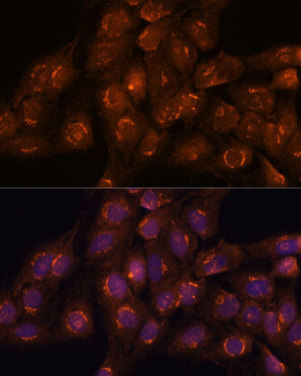ACBD3 Rabbit Polyclonal Antibody (CAB16568)